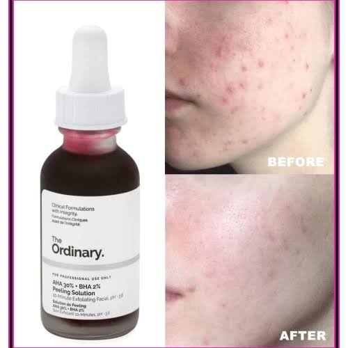 AHA 30% + BHA 2% Peeling Solution