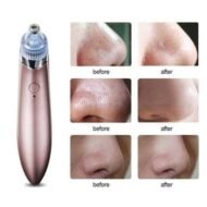 pore cleaner - Image 2